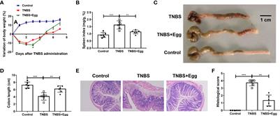 Protective effect of Schistosoma japonicum eggs on TNBS-induced colitis is associated with regulating Treg/Th17 balance and reprogramming glycolipid metabolism in mice